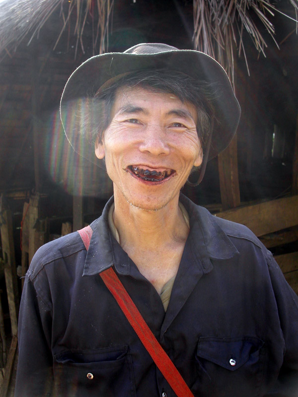 thailand/2004/trek_tribal_man_teeth